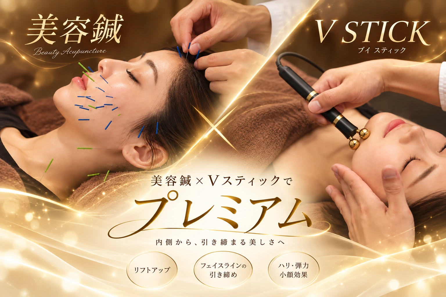 美容鍼とVスティックを組み合わせた美容鍼プレミアムのイメージ